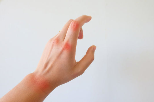 red dots on a white hand indicating pain and red swelling points on the joints