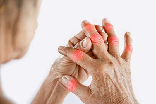 red inflamed joints in hands, old hands